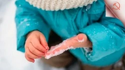 Профилактика обморожений